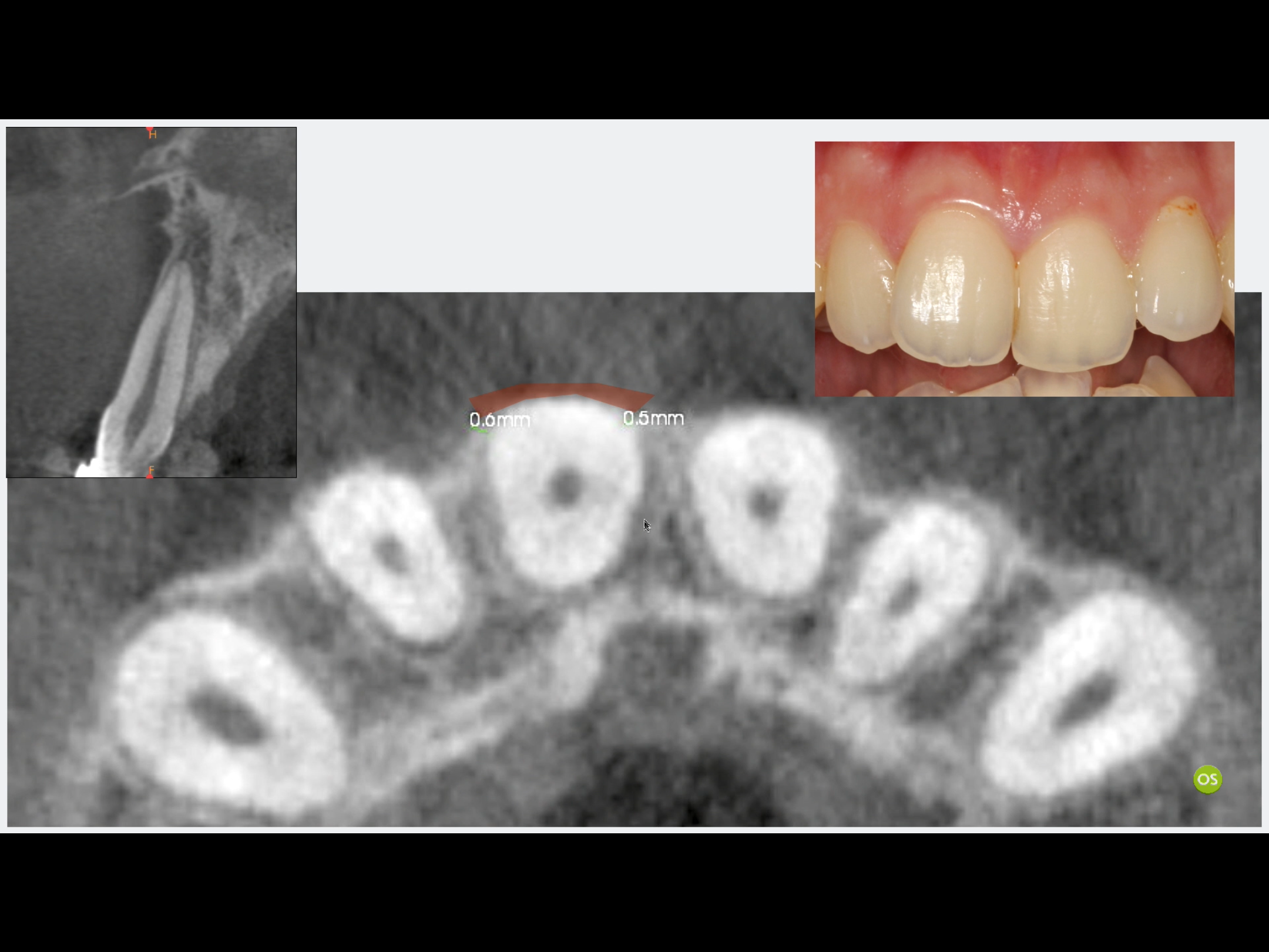 EBC456FE-D1E3-4BCF-9AF4-F13E8307C5E7