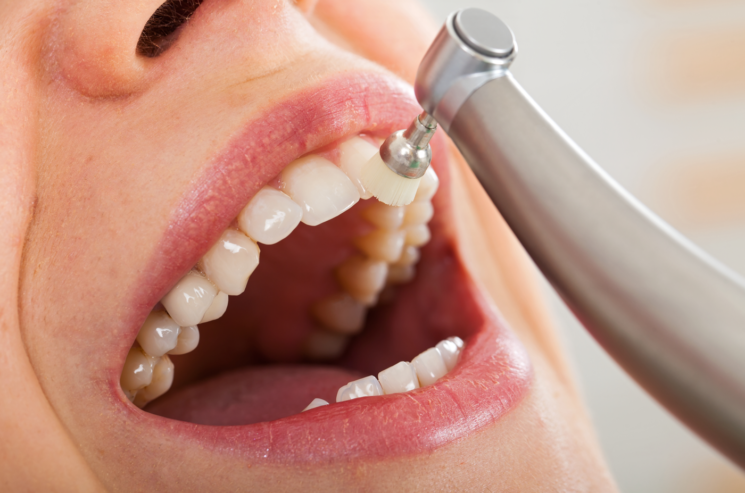 igiene-dentale