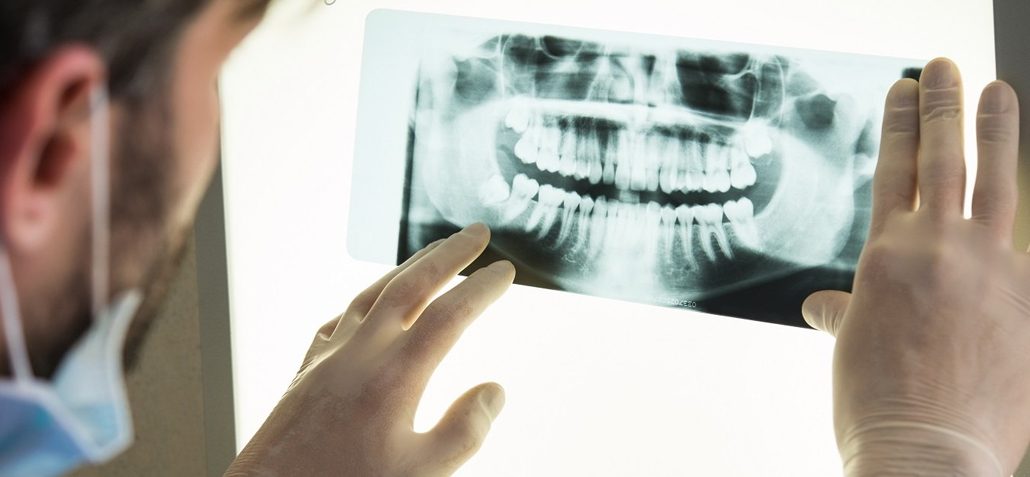 radiografie-dentali-1030×477-1